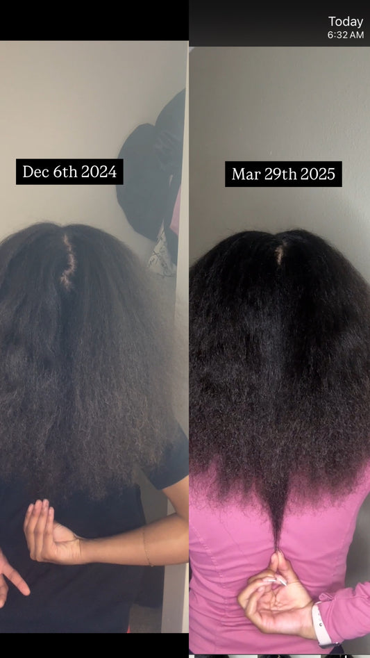 Double Growth Herbal Growth Oil